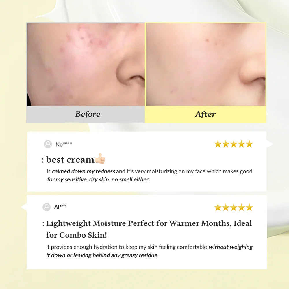 Dr.Althea 345 Relief Cream - Viral Korean Acne Removing Cream Survana