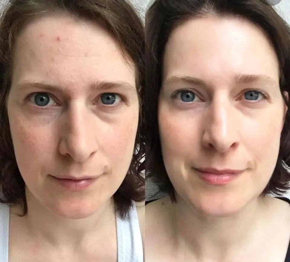 The Ordinary Retinol 1% in Squalane Directly Imported From - The ORDINARY CANADA đ¨đĻ