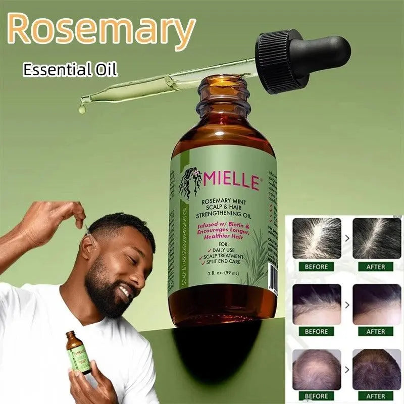 Mielle 59ML Original Rosemary Oil For Organics Hair Loss Treatment 📌 No 1 Bestseller in the world for Hairfall 💥