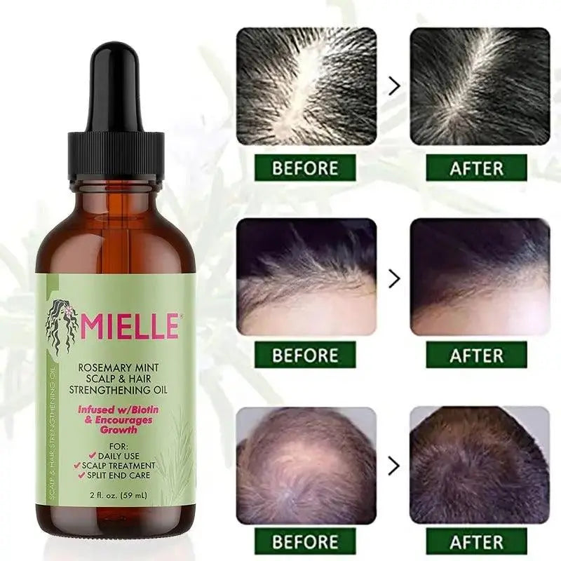 Mielle 59ML Original Rosemary Oil For Organics Hair Loss Treatment 📌 No 1 Bestseller in the world for Hairfall 💥