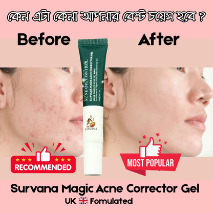 SURVANA Magic Acne* Corrector Gel (UK 🇬🇧 Formulated)