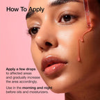 ANUA Niacinamide 10+ TXA 4 Serum 30mL - New Version Survana