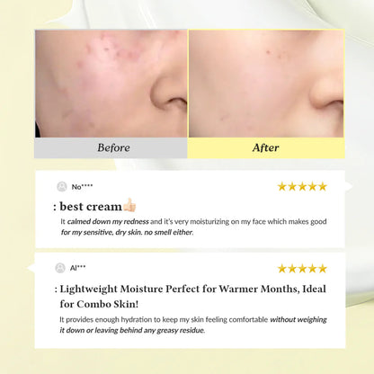 Dr.Althea 345 Relief Cream - Viral Korean Acne Removing Cream Survana
