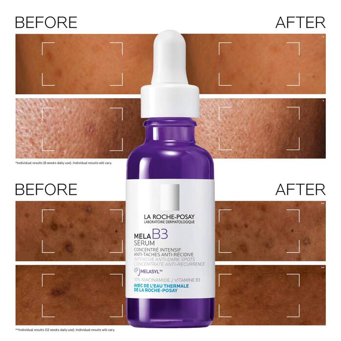 La Roche-Posay Mela B3 Dark Spot Serum With Melasyl™ + Niacinamide 30ml 🇫🇷 La Roche Posay - Imported from France 🇫🇷