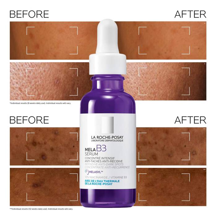 La Roche-Posay Mela B3 Dark Spot Serum With Melasyl™ + Niacinamide 30ml