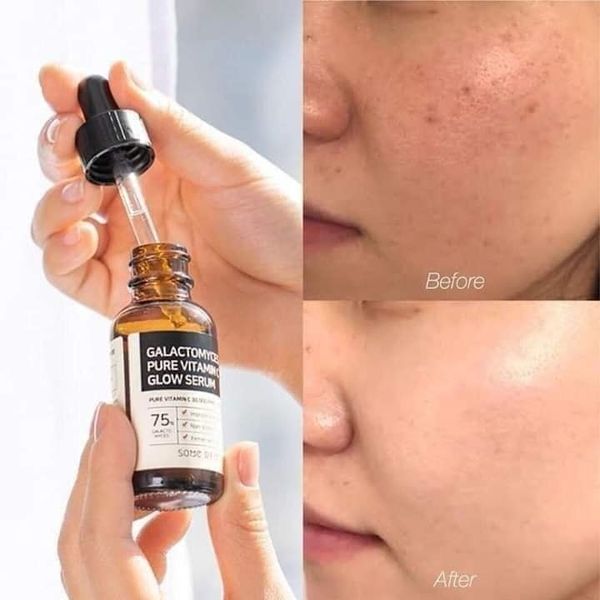 SOME BY MI Galactomyces Pure Vitamin C Glow Serum