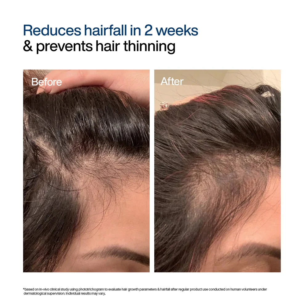 Wishcare Hair Growth Serum Concentrate Roll-On 30mL
