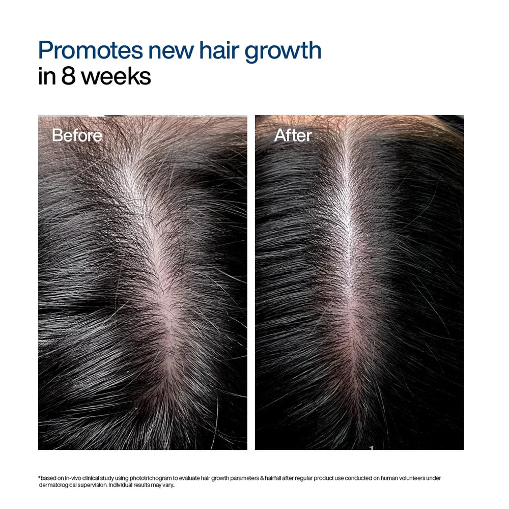 Wishcare Hair Growth Serum Concentrate Roll-On 30mL