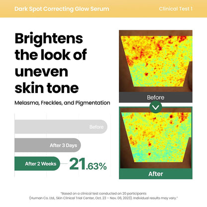 Axis-Y Dark Spot Correcting Glow Serum 50ml / 1.69 Fl. Oz