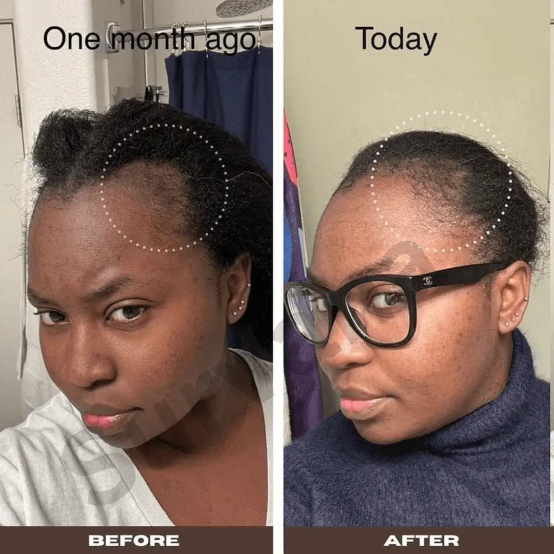 The Ordinary Multi-Peptide Hair Serum For Hair Density 60mL - Latest Version - 100% Authentic 🇨🇦 ⭐️⭐️⭐️⭐️⭐️ 25000+ 5 Star Reviewed