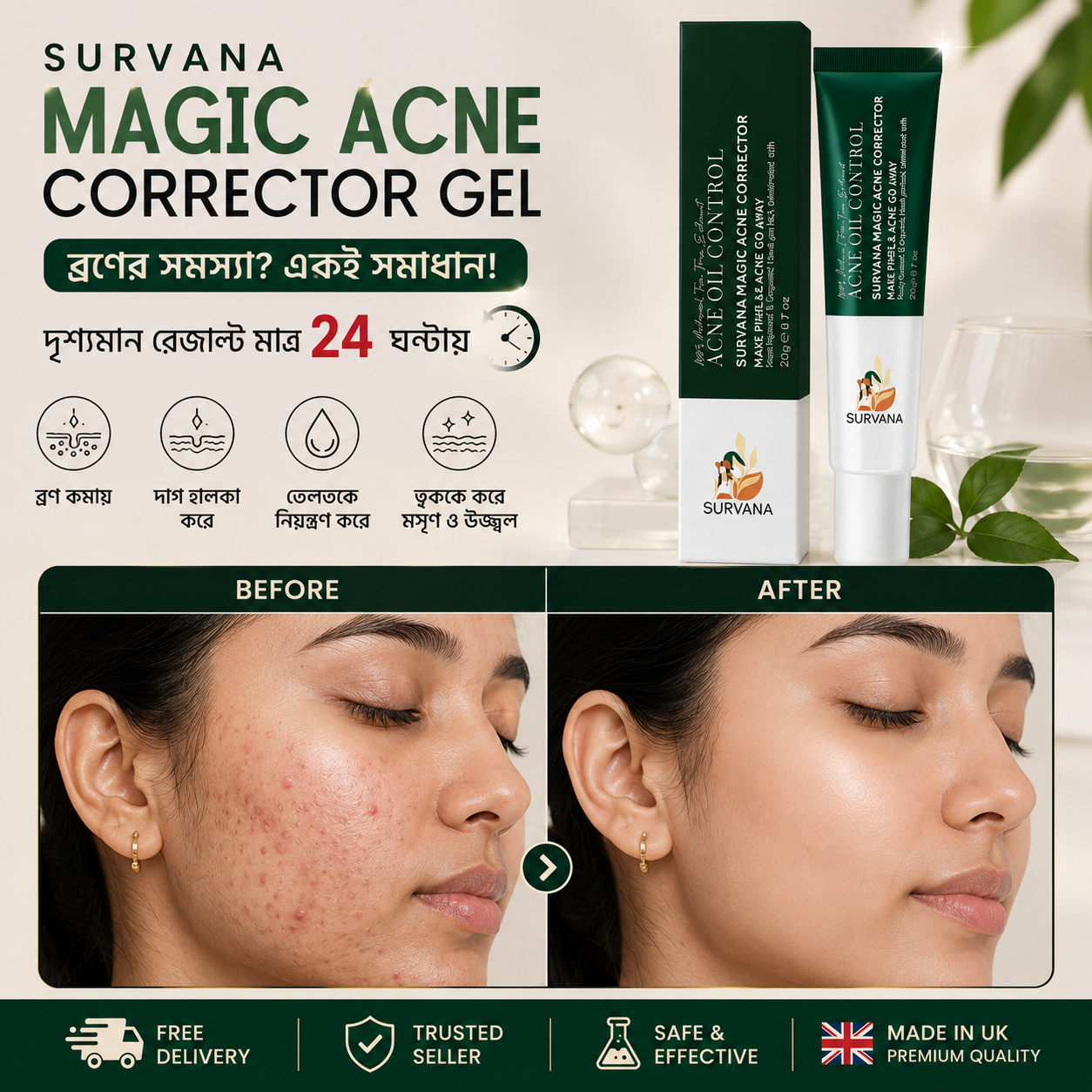 SURVANA Magic Acne* Corrector Gel (UK 🇬🇧 Formulated)
