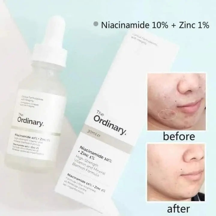The Ordinary Niacinamide 10%+ Zinc 1% Serum 30mL - 100% Authentic Directly Imported From - The ORDINARY CANADA 🇨🇦