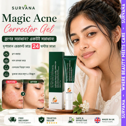 SURVANA Magic Acne* Corrector Gel (UK 🇬🇧 Formulated)