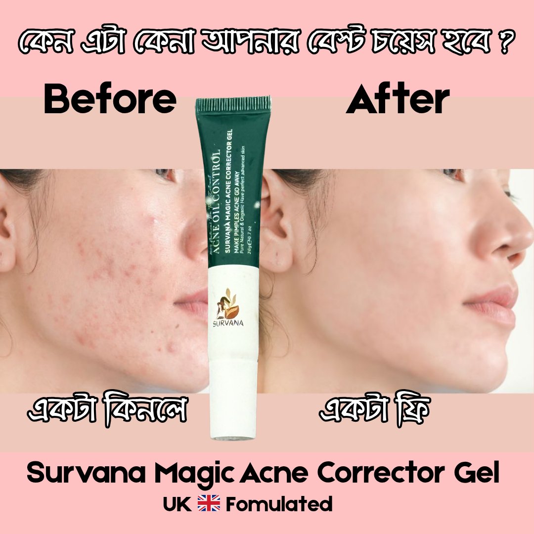 SURVANA Magic Acne* Corrector  Gel 20g (Buy 1 Get 1 Free) Survana